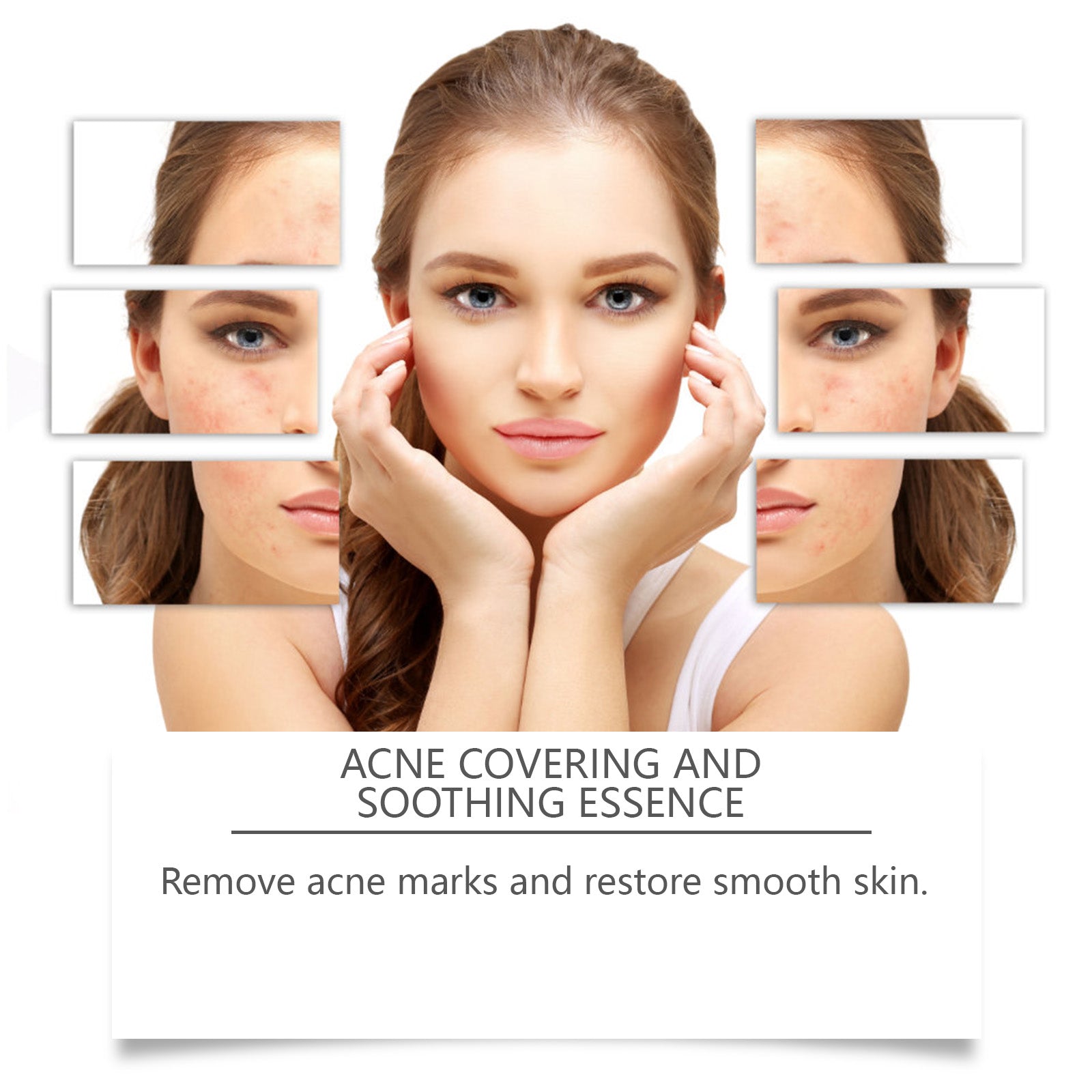 Acne Soothing Serum Hydrating Moisturizing Care for Pimple Prone Facial Skin