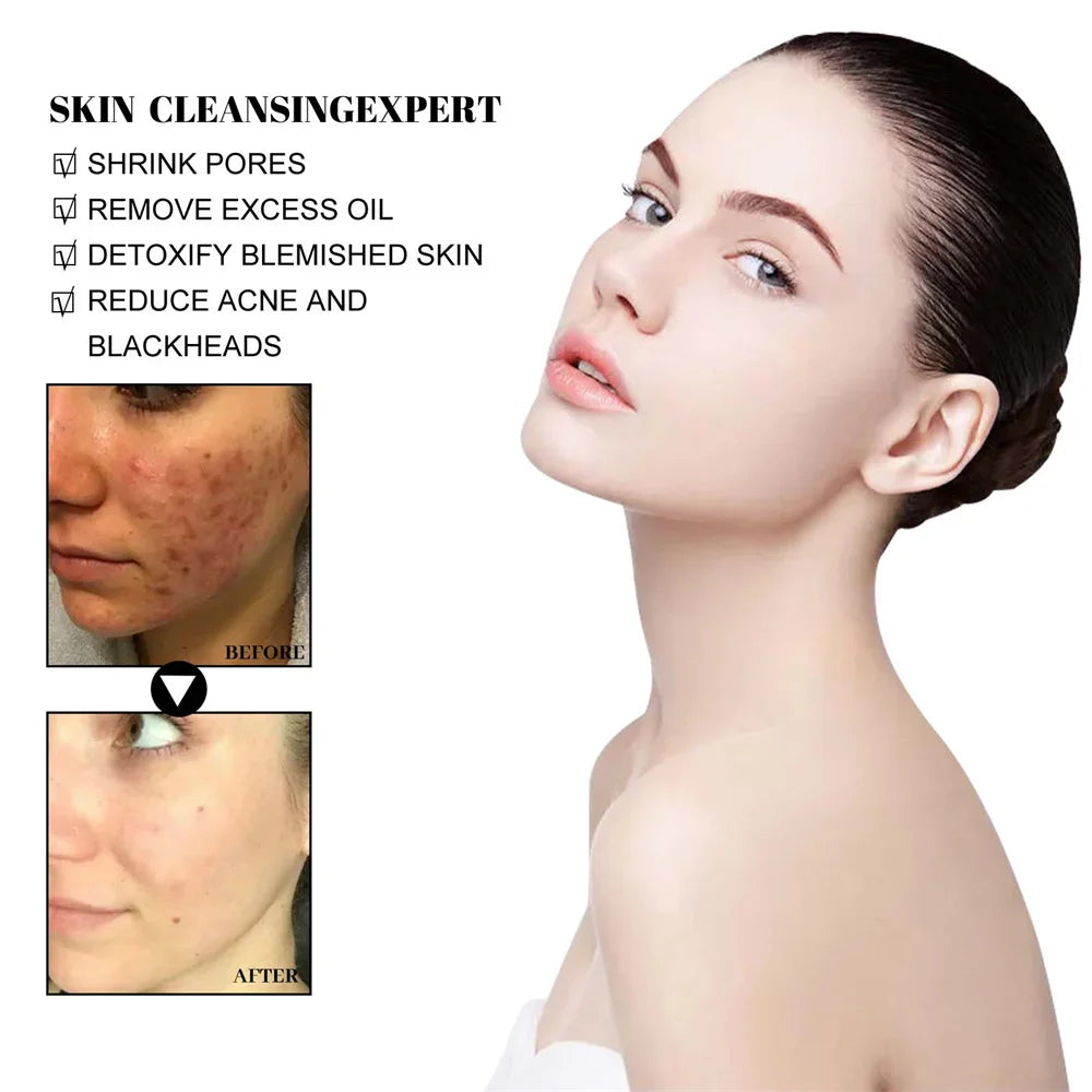 West Month Blackhead Mud Mask Controls Oil Shrinks Pores and Moisturizes